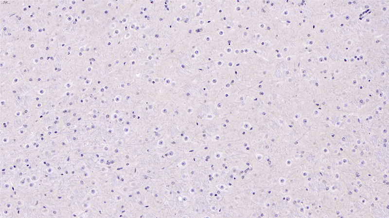 Beta amyloid (WT)